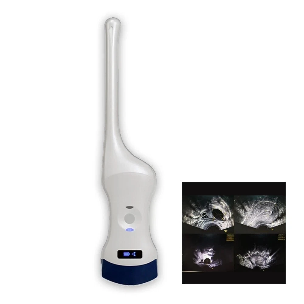 Phone/iPad Supported Ultrasound Probe, Wireless Transvaginal Scanner, Color PDI Mode, WIFI & USB Charging, Compact Build