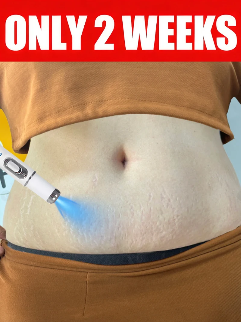 

Postpartum skin care tools Products For Body Stretch Marks