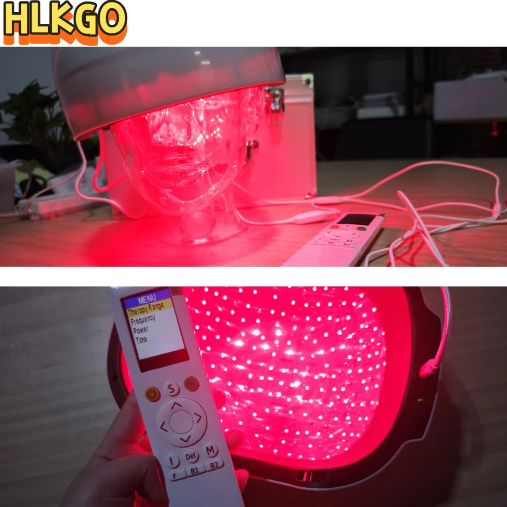 

Новый лазерный шлем для роста волос 2026 года с 300 диодами (красный лазер), для лечения против выпадения волос и стимуляции роста волос