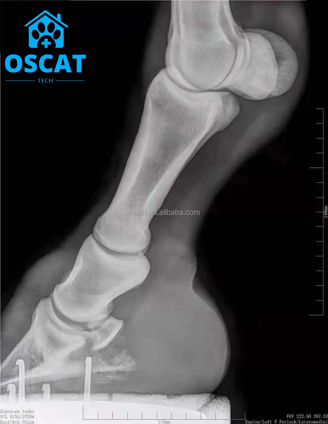 OSCAT Favorable Price Digital X-ray Machine 32kw Medical Radiography Machine X Ray Machine With Flat Panel Detector