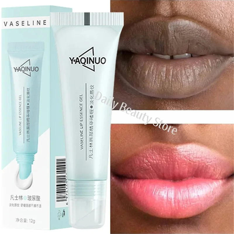 Π£Π΄Π°Π»Π΅Π½ΠΈΠ΅ ΡΠ΅ΠΌΠ½ΡΡ
Π³ΡΠ± ΠΠ°Π»ΡΠ·Π°ΠΌ Π΄Π»Ρ Π³ΡΠ± ΠΡΡΡΡΠΎΠ΅ ΠΎΡΠ²Π΅ΡΠ»Π΅Π½ΠΈΠ΅ Π ΠΎΠ·ΠΎΠ²ΡΠ΅ ΠΎΡΡΠ΅Π»ΡΡΠΈΠ²Π°ΡΡΠΈΠ΅ Π³ΡΠ±Ρ ΠΡΡΠ²Π΅ΡΠ°Π½ΠΈΠ΅ Π»ΠΈΠ½ΠΈΠΈ Π³ΡΠ± Π£Π²Π»Π°ΠΆΠ½ΡΡΡΠΈΠΉ ΠΊΡΠ΅ΠΌ Π΄Π»Ρ ΠΎΠΌΠ΅ΡΡΠ²Π΅Π²ΡΠ΅ΠΉ ΠΊΠΎΠΆΠΈ ΠΠΎΡΠ΅ΠΉΡΠΊΠΈΠ΅ ΡΡΠ΅Π΄ΡΡΠ²Π° ΠΏΠΎ ΡΡ
ΠΎΠ΄Ρ ΠΡΠ°ΡΠΎΡΠ° ΠΠ΄ΠΎΡΠΎΠ²ΡΠ΅ Π£Π΄Π°Π»Π΅Π½ΠΈΠ΅ ΡΠ΅ΠΌΠ½ΡΡ
Π³ΡΠ± ΠΠ°Π»ΡΠ·Π°ΠΌ Π΄Π»Ρ Π³ΡΠ± ΠΡΡΡΡΠΎΠ΅ ΠΎΡΠ²Π΅ΡΠ»Π΅Π½ΠΈΠ΅ Π ΠΎΠ·ΠΎΠ²ΡΠ΅ ΠΎΡΡΠ΅Π»ΡΡΠΈΠ²Π°ΡΡΠΈΠ΅ Π³ΡΠ±Ρ ΠΡΡΠ²Π΅ΡΠ°Π½ΠΈΠ΅ Π»ΠΈΠ½ΠΈΠΈ Π³ΡΠ± Π£Π²Π»Π°ΠΆΠ½ΡΡΡΠΈΠΉ ΠΊΡΠ΅ΠΌ Π΄Π»Ρ ΠΎΠΌΠ΅ΡΡΠ²Π΅Π²ΡΠ΅ΠΉ ΠΊΠΎΠΆΠΈ ΠΠΎΡΠ΅ΠΉΡΠΊΠΈΠ΅ ΡΡΠ΅Π΄ΡΡΠ²Π° ΠΏΠΎ ΡΡ
ΠΎΠ΄Ρ ΠΡΠ°ΡΠΎΡΠ° ΠΠ΄ΠΎΡΠΎΠ²ΡΠ΅