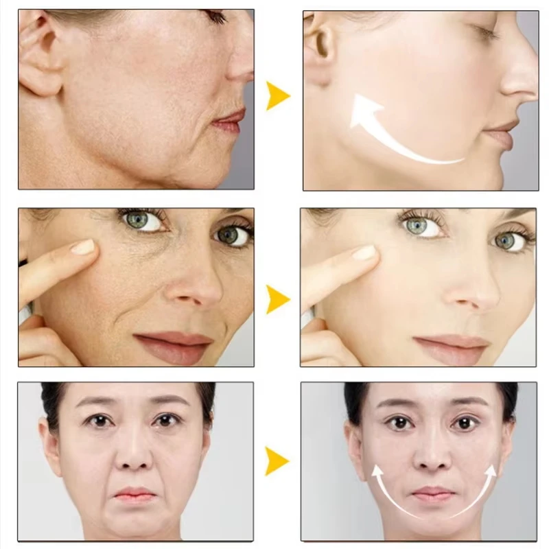 Remoção instantânea de rugas creme retinol rosto anti-envelhecimento endurecimento levantamento desbotamento linhas finas melhorar a pele hidratar iluminar cuidados com a pele