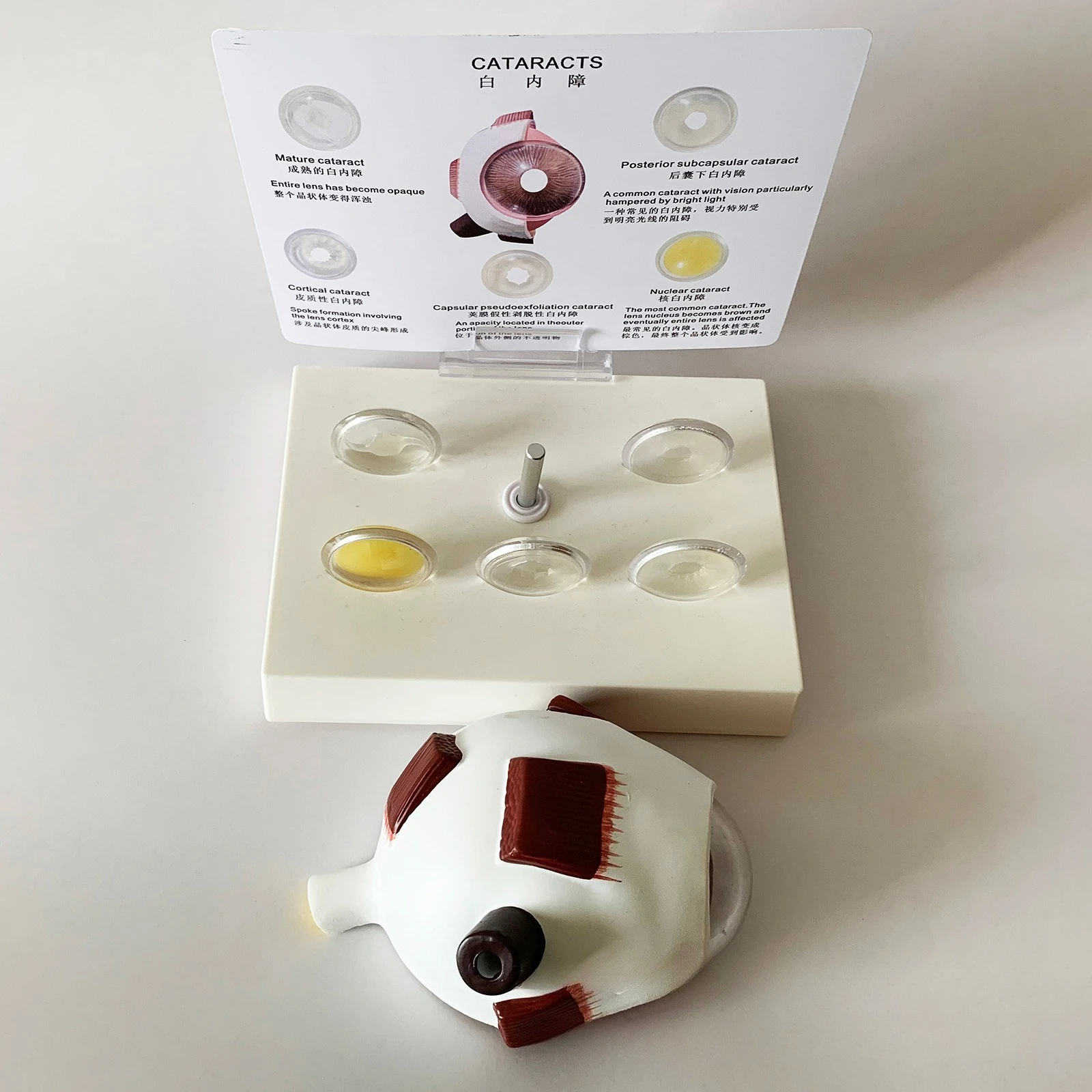 

Eye anatomy model lens opacity demonstration medical teaching model