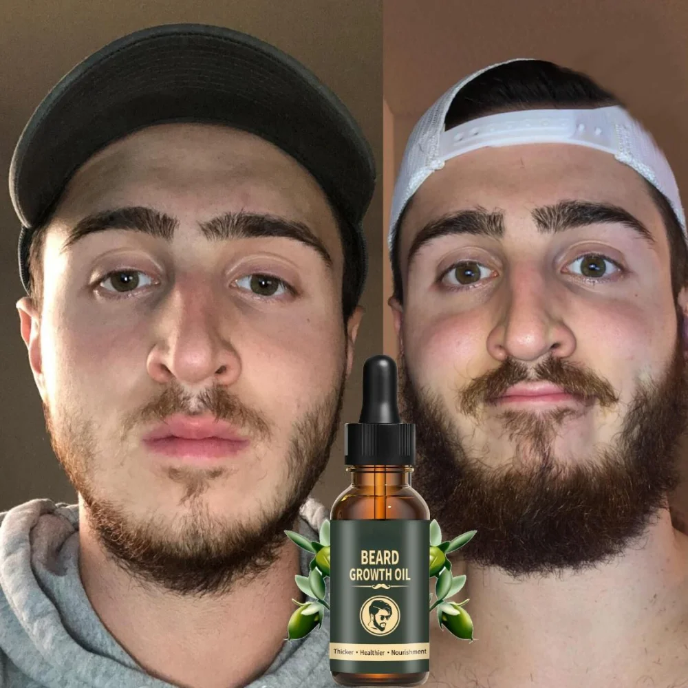 KerBrian-Huile de croissance r - Caffeine Hair Serum avis et prix