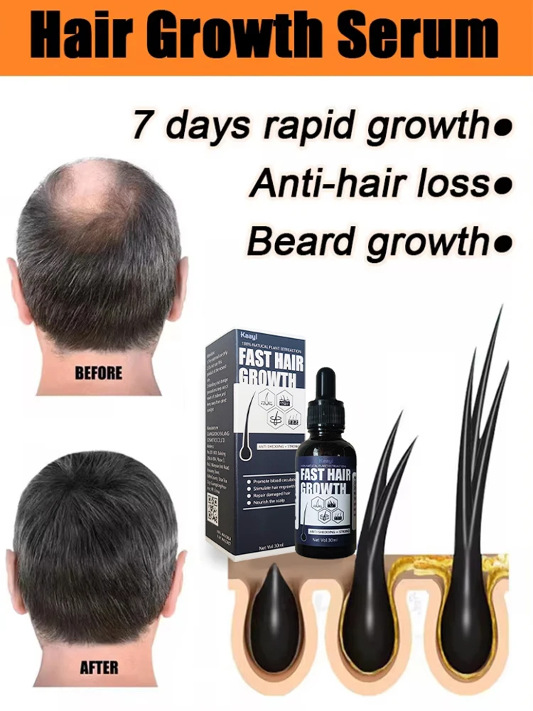 

【have more and more hair】Hot selling product, 99% of buyers buy again, say goodbye to baldness, , thick hair