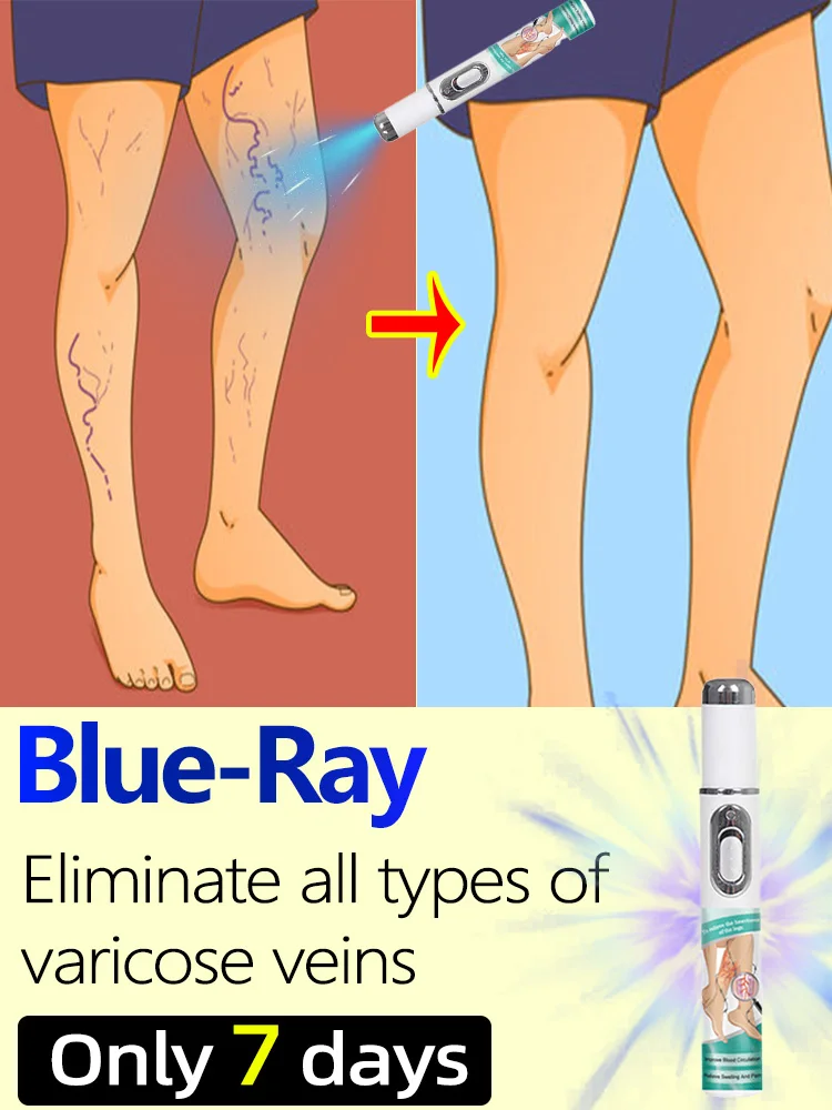 

Vein blue light tool Combination Set Package Tools Can be purchased individually or in combination Says Goodbye To Spider Legs