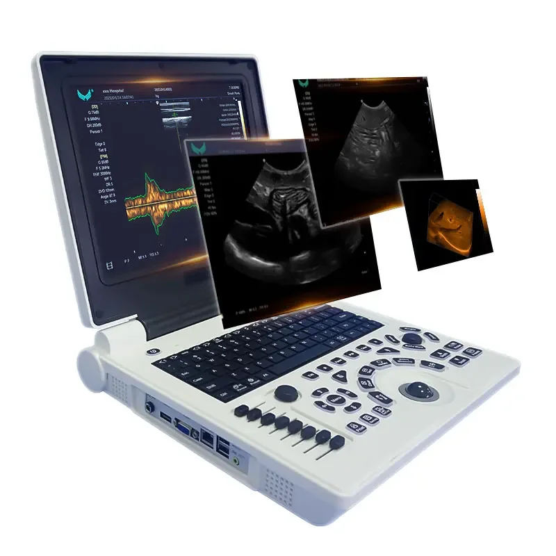 

Veterinary Instrument Portable Full Digital Ultrasound Machine B/W Laptop Ultrasound Scanner