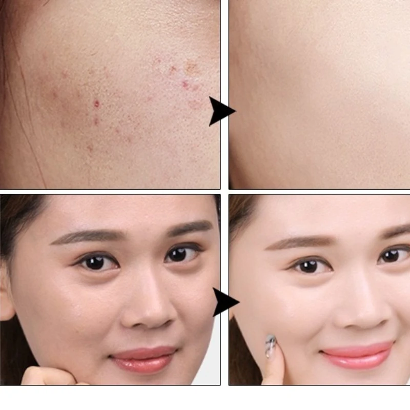 Mushroom Air Cushion Plant Nourishing BB Cream Concealer Moisturizing Foundation Fluid Isolating Plain Cc Cream Women Makeup New