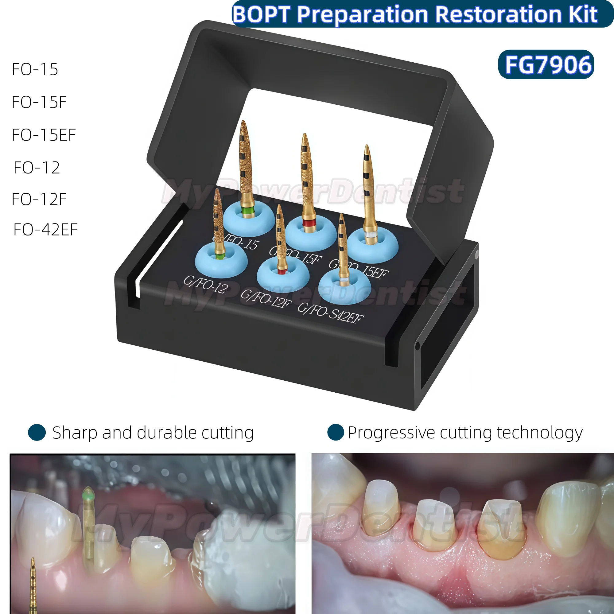 

Dental Preparation Bur BOPT Kit Vertical Restoration Crown Restoration FG7906