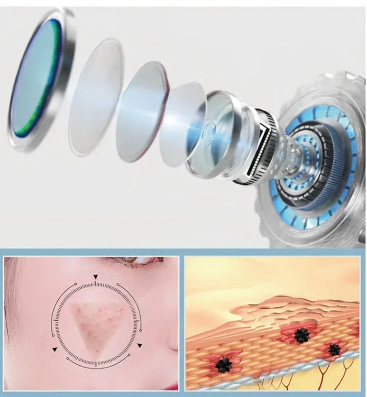 

Top Quality First7 Probes Oxygen Hydro Jet Peel Therapy Hyrodermabrasion Machine For Beauty