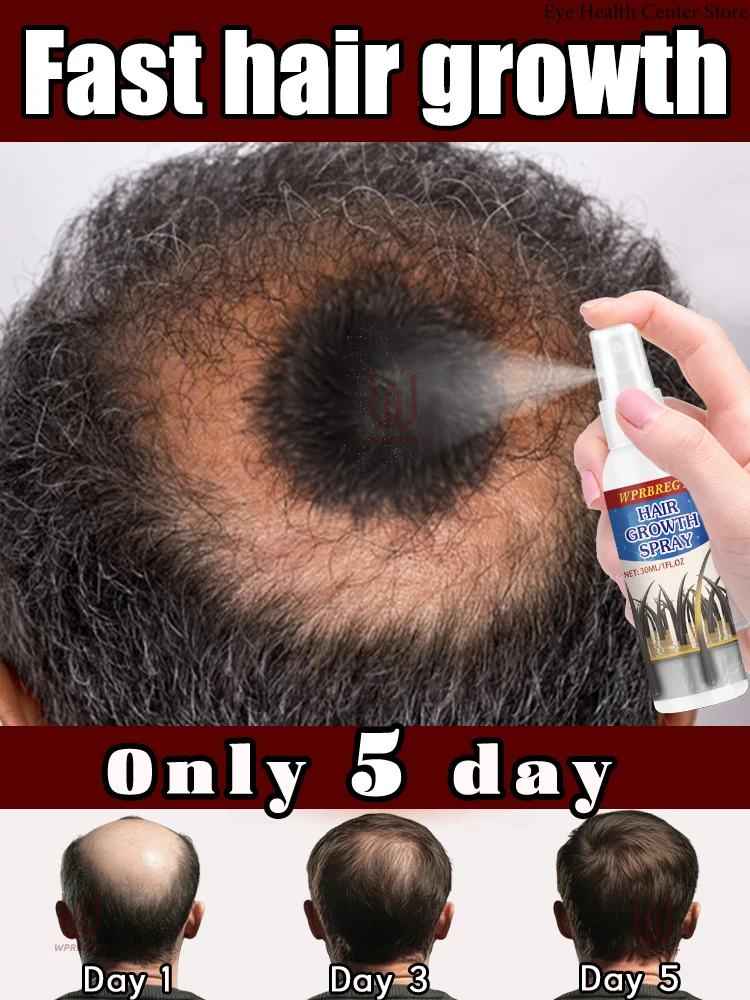 

#1 Sᴇʟʟᴇʀ, Hair nourishing formula, ᴀᴅᴅs 100% ᴠᴏʟᴜᴍᴇ, ᴀᴅᴅs 10ᴄᴍ ᴛᴏ ʜᴀɪʀ