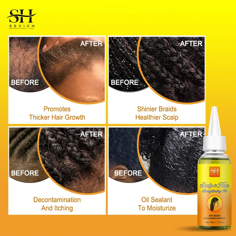 2023 new 50ML Hair Antipruritus Growth Oil for braids protective hairstyles relieve itchyand flaky scalp prevent hair loss