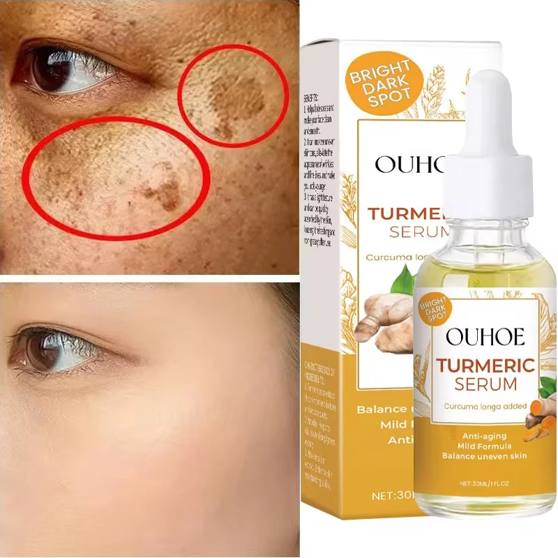 Turmeric Whitening Face Brighten Serum Fade Dark Spots Remover Freckle melasma Age Spots Melanin Correcting Skin Care Products