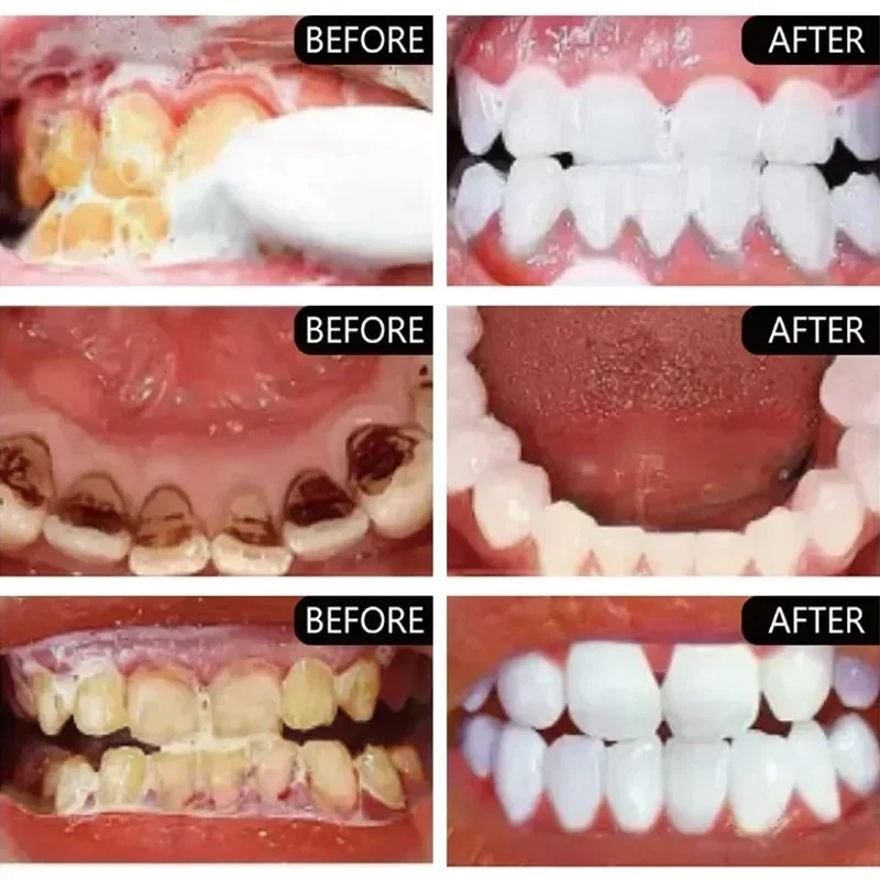 Pasta de dientes rápida para eliminar manchas de humo, tiras para blanquear los dientes, higiene bucal, aliento fresco, herramientas dentales