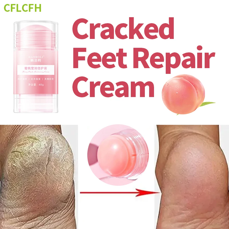 

Anti Crack Drying Foot Cream Cracked Peeling Feet Repair Dead Dry Skin Removal Hand Heel Cracking Mask Moisturizing Care 40g