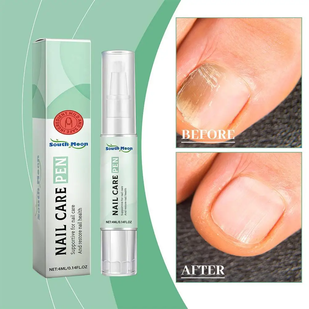 Nail Repair Solution Nail Care Repair Pen Gentle Formula Strong Nail Polish Repair Nails Healthy And Easy To Use