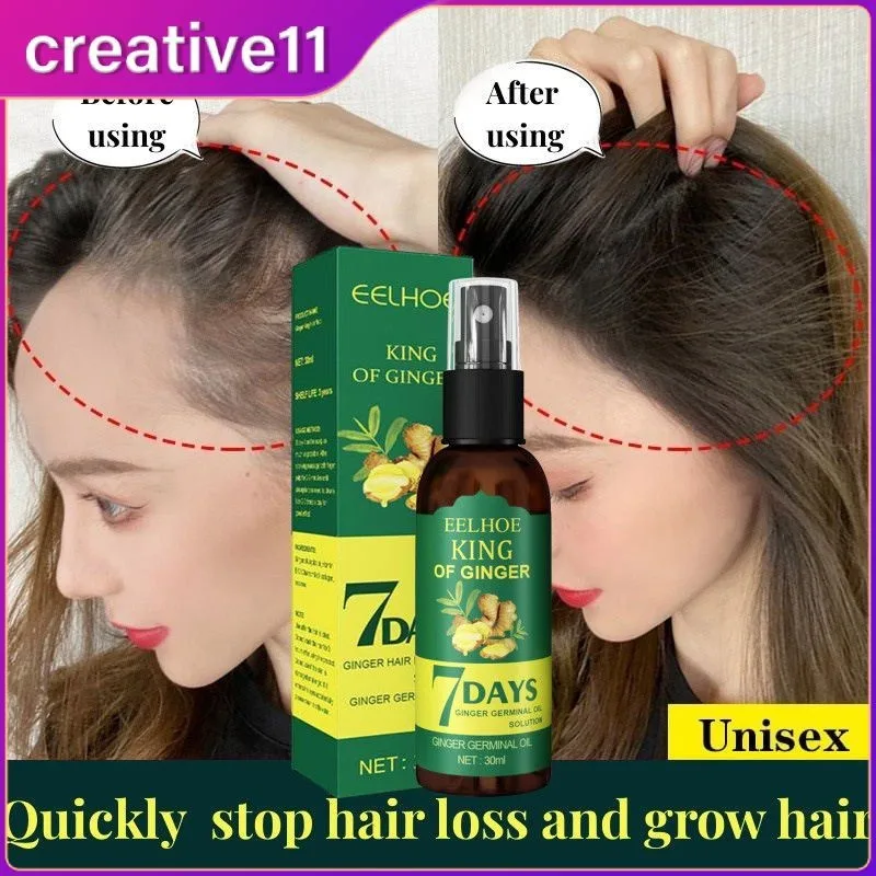 

7DAYS Hair Growth Serum Spray Anti Hair Loss 30ml Hair Growth Promotes Thicker Stronger Hair Hair Regrowth for Men Women