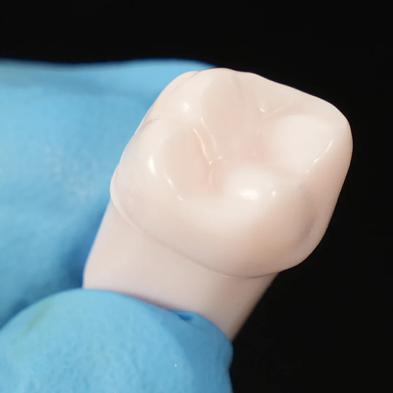 13 Type Dental Endodontic Teeth Model White Root Canal Pulp Cavity Medullary Endo Study Training Practice Block