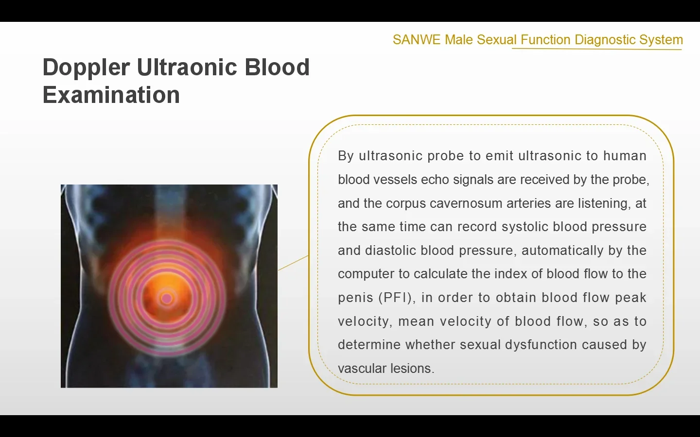 SW-3603 Andrology Medical Diagnostic  Male sexual dysfunction diagnostic with blood flu dopplor probe