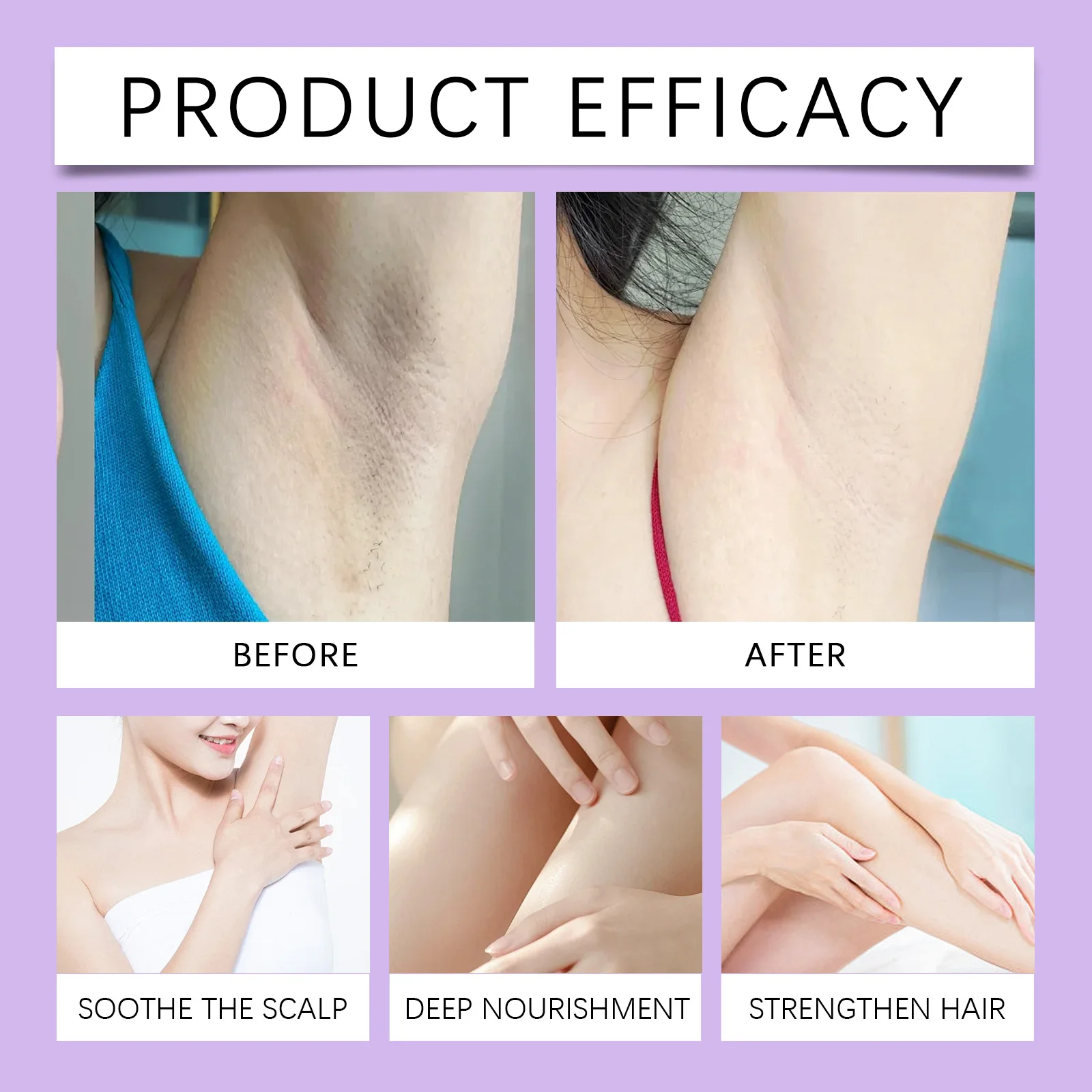 سيروم السيبرس روتاندوس للبشرة زيت إزالة الشعر الطبيعي للنساء إزالة شعر الجسم السائل مثبط نمو الشعر غير مهيج آمن #5