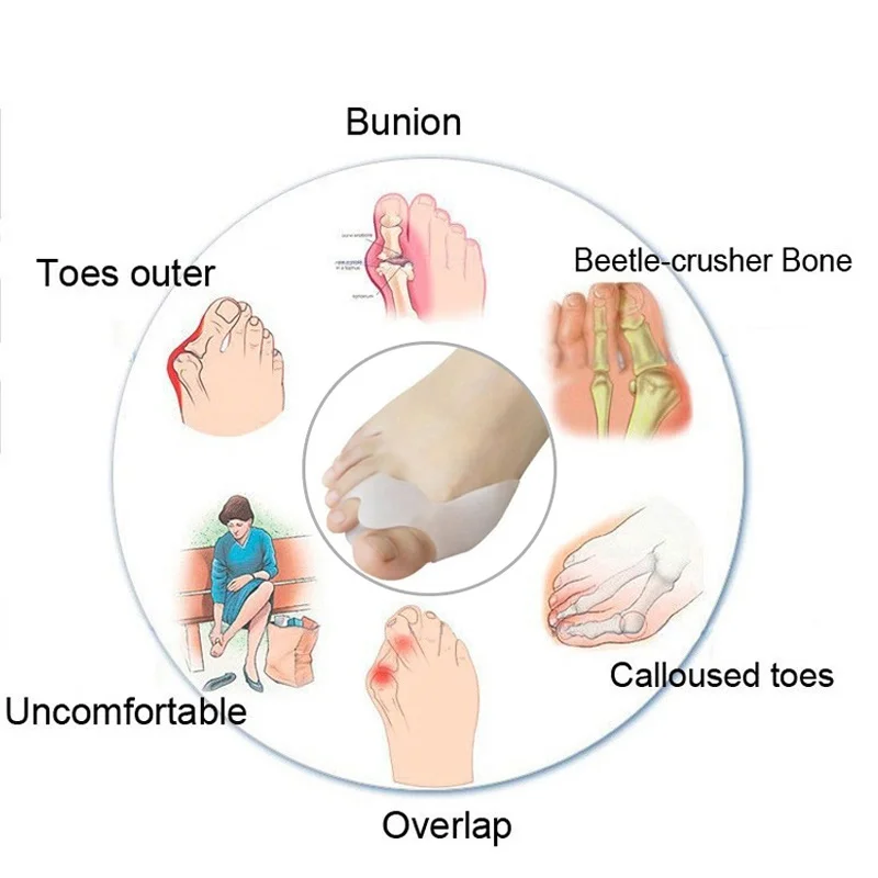 1 زوج الإبهام مستقيم أصابع فاصل أروح الورم مصحح أداة العناية بالقدم لجهاز تصحيح أروح الباديكير #4