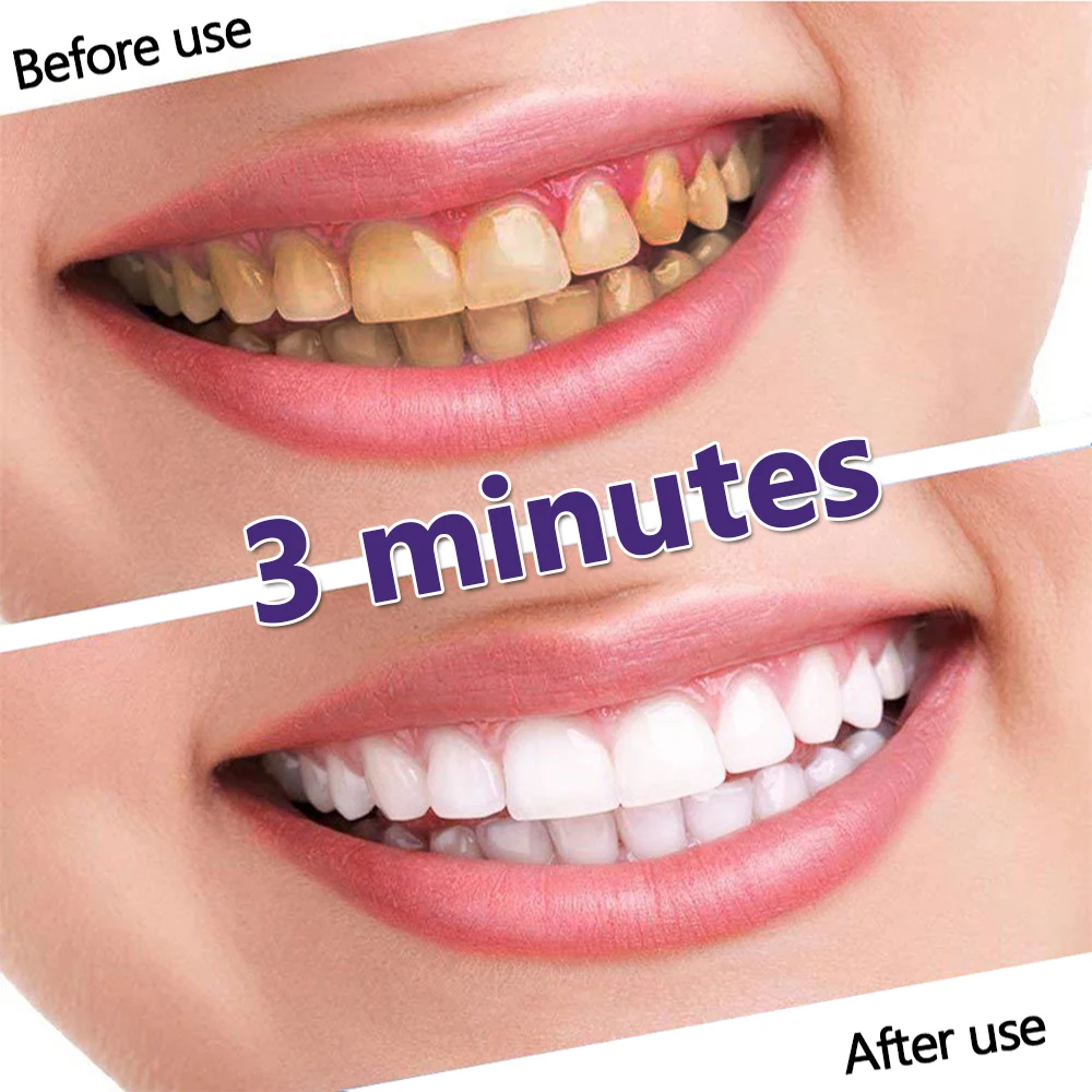 Repair Bright White Anti-Sensitive Toothpaste Gel Gentle Whitening Toothpaste Remove Smoke Stains Plaque Fresh Breath Teeth Care