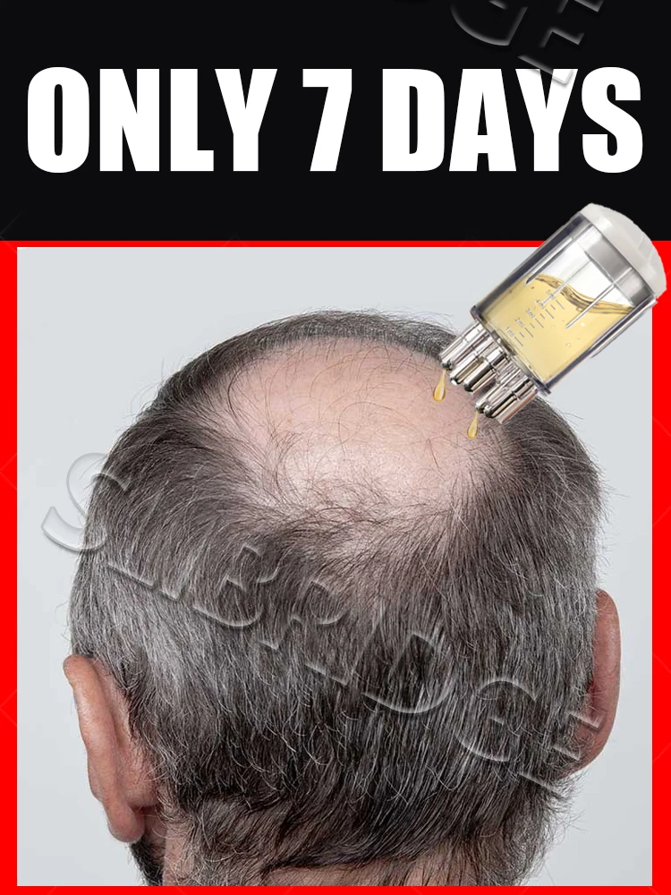 

2025 Hot sale Scalp Applicator Liquid Comb Portable Massage Combs Fluid Guiding Massager Anti Hair Loss Head Care Tools