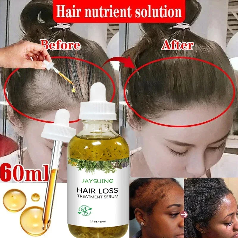 

Fast Hair Growth Serum African Crazy Traction Alopecia Anti Hair Loss Essential Oil Prevent Baldness Scalp Repair Hair Care 60ml