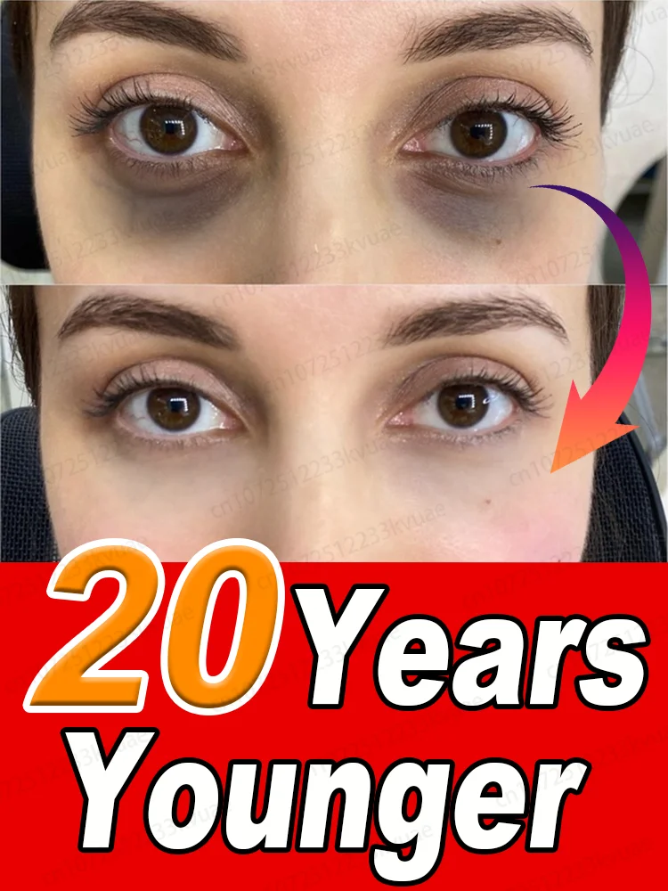 

Instantly remove eye bags, reduce fine lines, tighten skin, fight dark circles, and brighten eyes