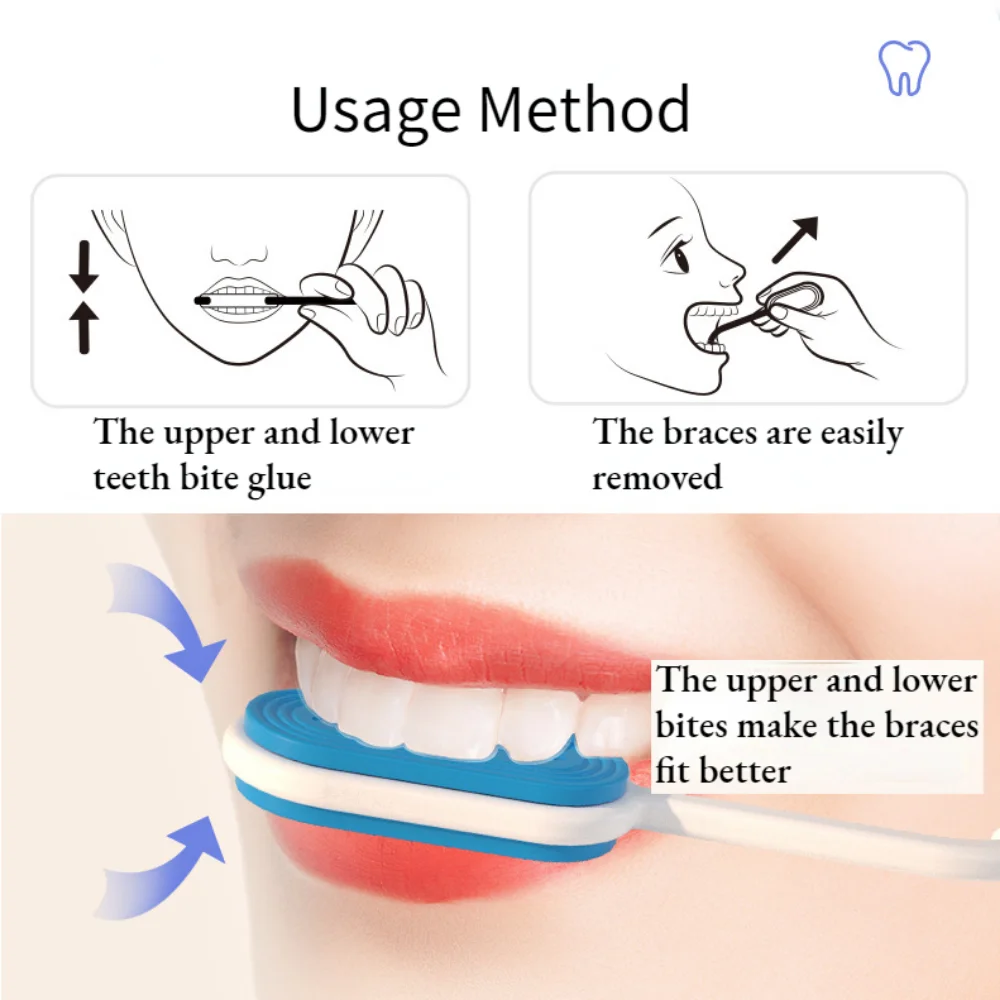 Dissolvant d'accolades orthodontiques dentaires, poignées d'accolades invisibles amovibles, déterminer la colle de morsure, 2 en 1, 1 pièce par paquet