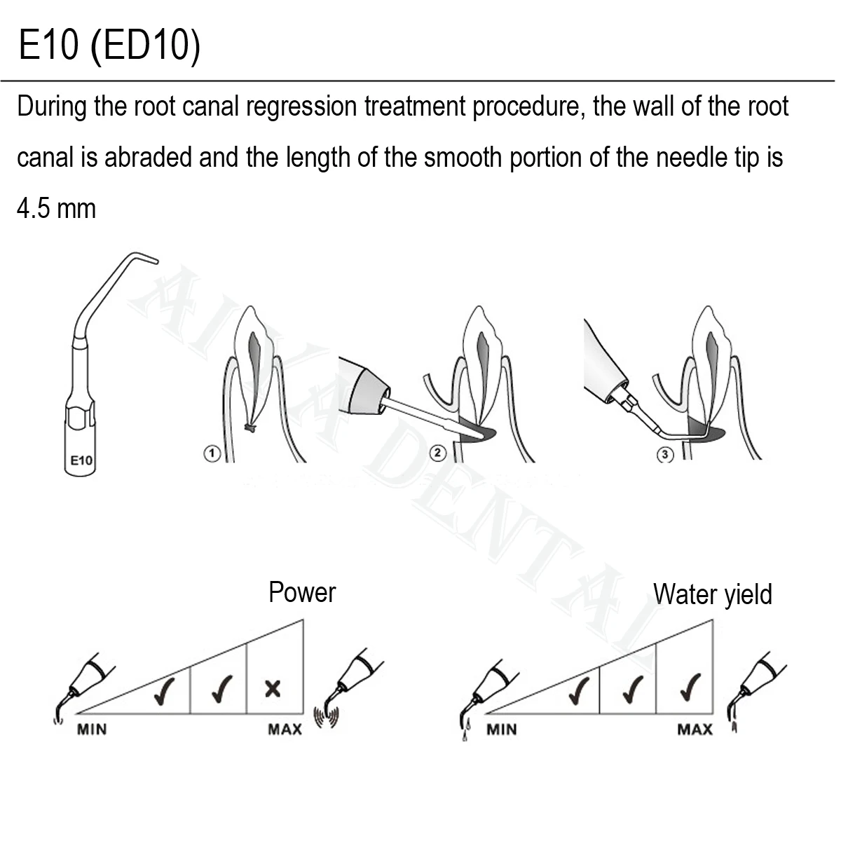 نقار الخشب DTE الأسنان قشارة بالموجات فوق الصوتية نصائح إندو تفعيل أدوات طب الأسنان ملحقات المواد صالح satbic DTE NSK قشارة