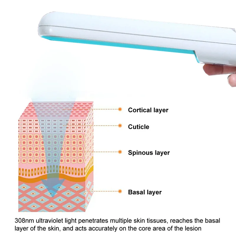 

311NM UVB Phototherapy Light Device for Vitiligo Treatment Lamp NarrowBand Ultraviolet Light Therapy Psoriasis Therapy Lamp
