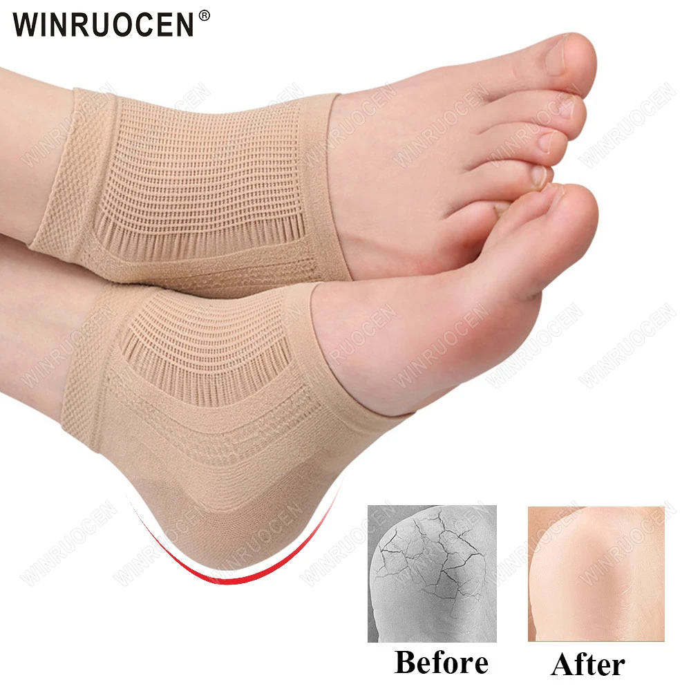 

Silicone Heel Protector Pads Shock Absorption Relieving Leg Pressure Prevent Slipping Insoles Gel Mesh Socks Heel Cover Anti-dry