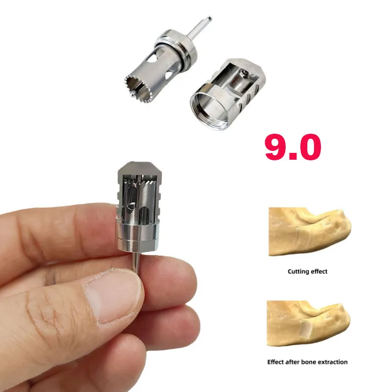 

1 шт. Стоматологический полумесяцевидный костеотсос GBR SLT для полумесяцевидной техники, для легкой ассимиляции костной ткани