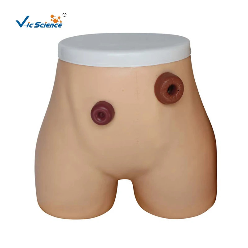 

Advanced Intramscar Ostomy Nursing Model