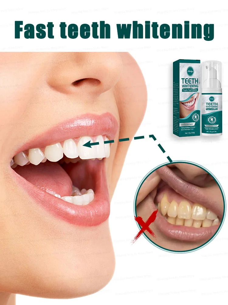 Whitening Toothpaste