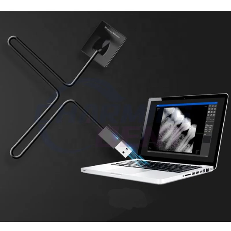 Xpect Vision Dental X Ray Sensor / Radiography Intraoral Sensor Digital Imaging System Rvg Sensor for Clinic