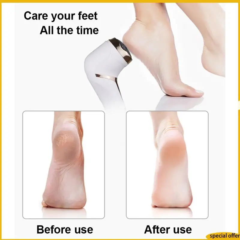 

A61I электрическое средство для удаления мозолей для ног портативный набор для педикюра перезаряжаемая водостойкая пилка для ног уход за ногами средство для удаления омертвевшей кожи