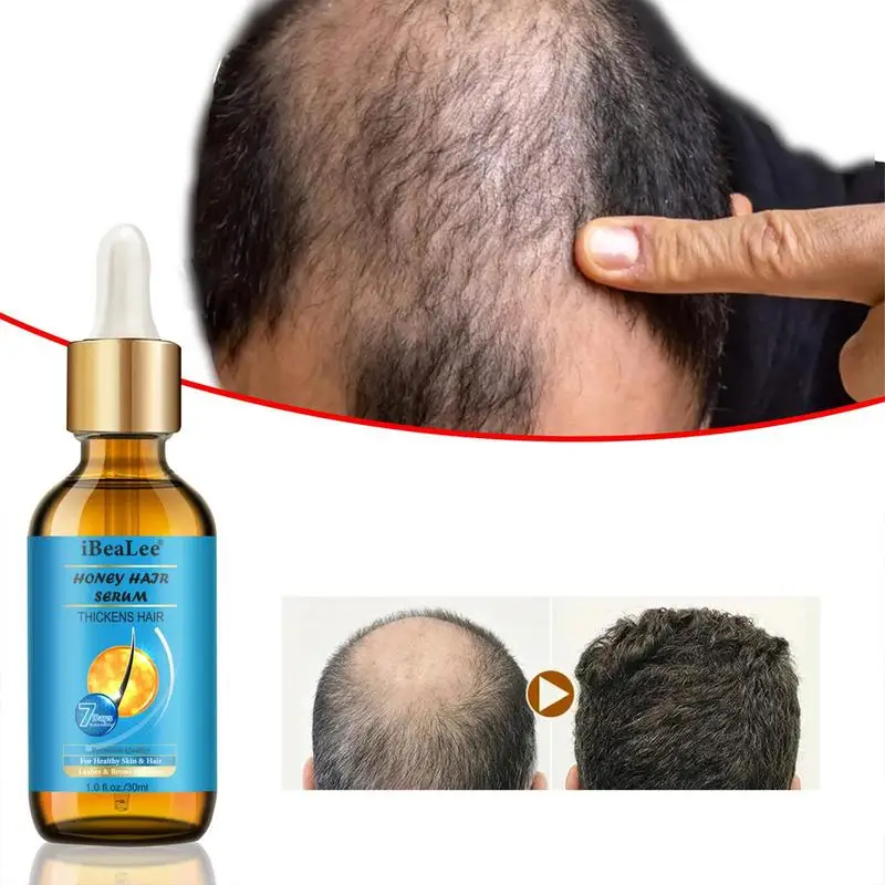 Óleo essencial para o crescimento do cabelo, 30ml, óleo essencial para o crescimento do cabelo, gengibre, para homens e mulheres