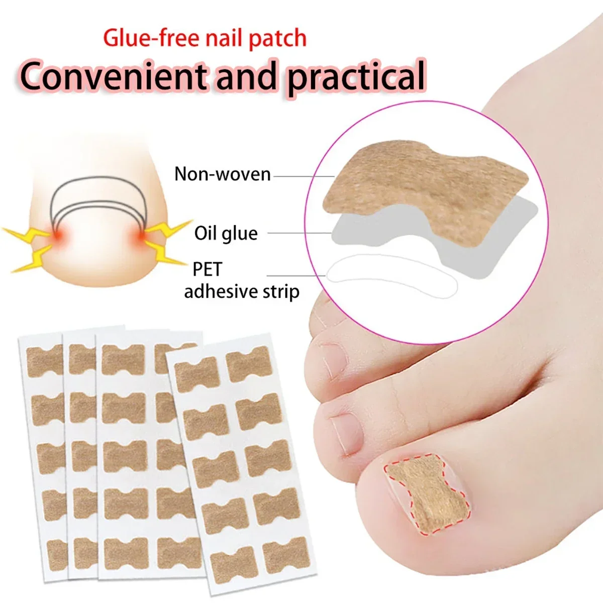 10/20/50/100pcs Nail Correction Stickers Ingrown Toenail Corrector Patches Paronychia Treatment Recover Corrector Pedicure Tools