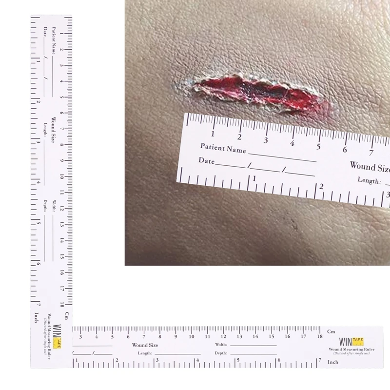 100 Pack Wound Measuring Tape Me dical Medimeter 18cm  7'' Educare Wound Ruler