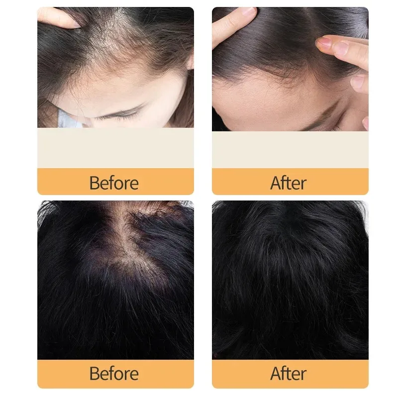 Hair Growth Oil Ginseng Ginger Polygonum Multiflorum Hair Growth Care Solution To Prevent Hair Loss Nutritional Care Accessories