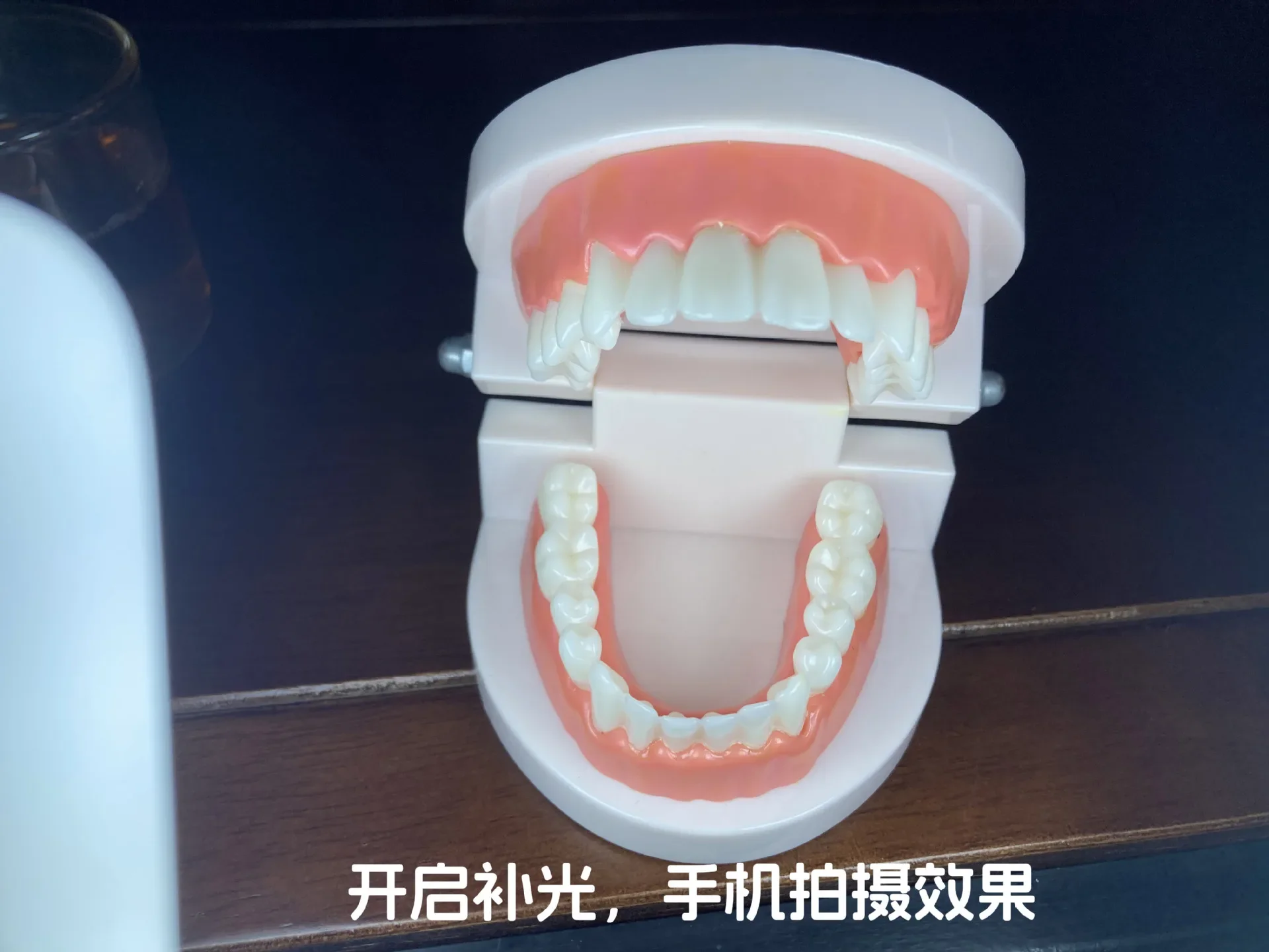 Dental Photography Clinic Light For Phone With Bluetooth Adjustable Colour Temperature Oral Intraoral Filling Light Lamp