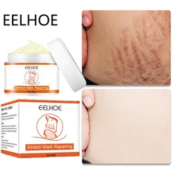 Stretch Mark Vanishing Cream Repair Anti-Wrinkle Anti-Aging Pregnant Women Stretch Marks Treatment Cream Vitamin E Skin Care 50g