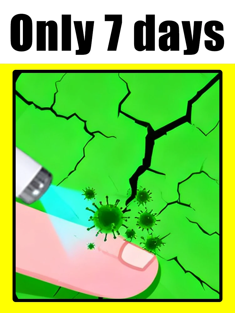 

Горячая распродажа 2025 года. Скажи прощайте с гвоздями. Простой и удобный.