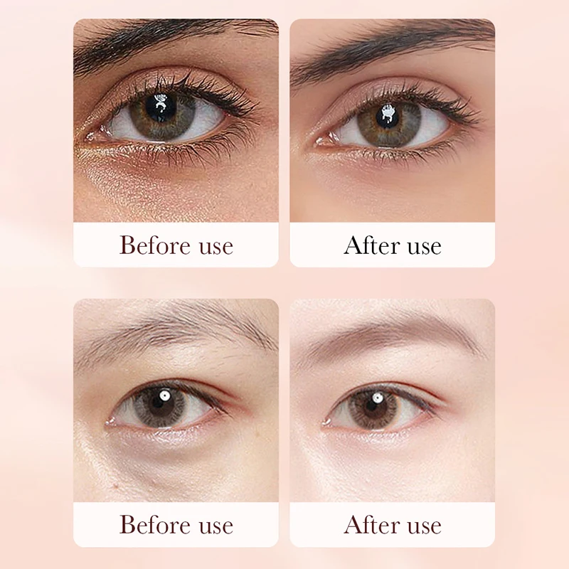 Instant Retinol Cream Eye Bag Removal Anti-Wrinkle Firming Skin Fade Fine Lines Anti Dark Circle Puffiness Brighten Eye skinCare