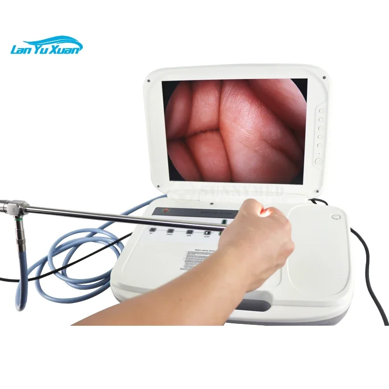 SY-P039 Medical Endoscope  All in One 1080P Full HD Portable Endoscope  for Ventricular Surgery