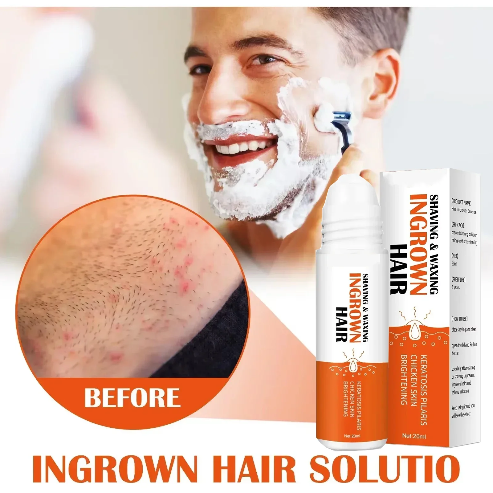 After Shave Serum Razor Bump Stopper for Men Women Waxing Ingrown Hair Remover Reduce Redness Skin Soothes Moisturizes Solution