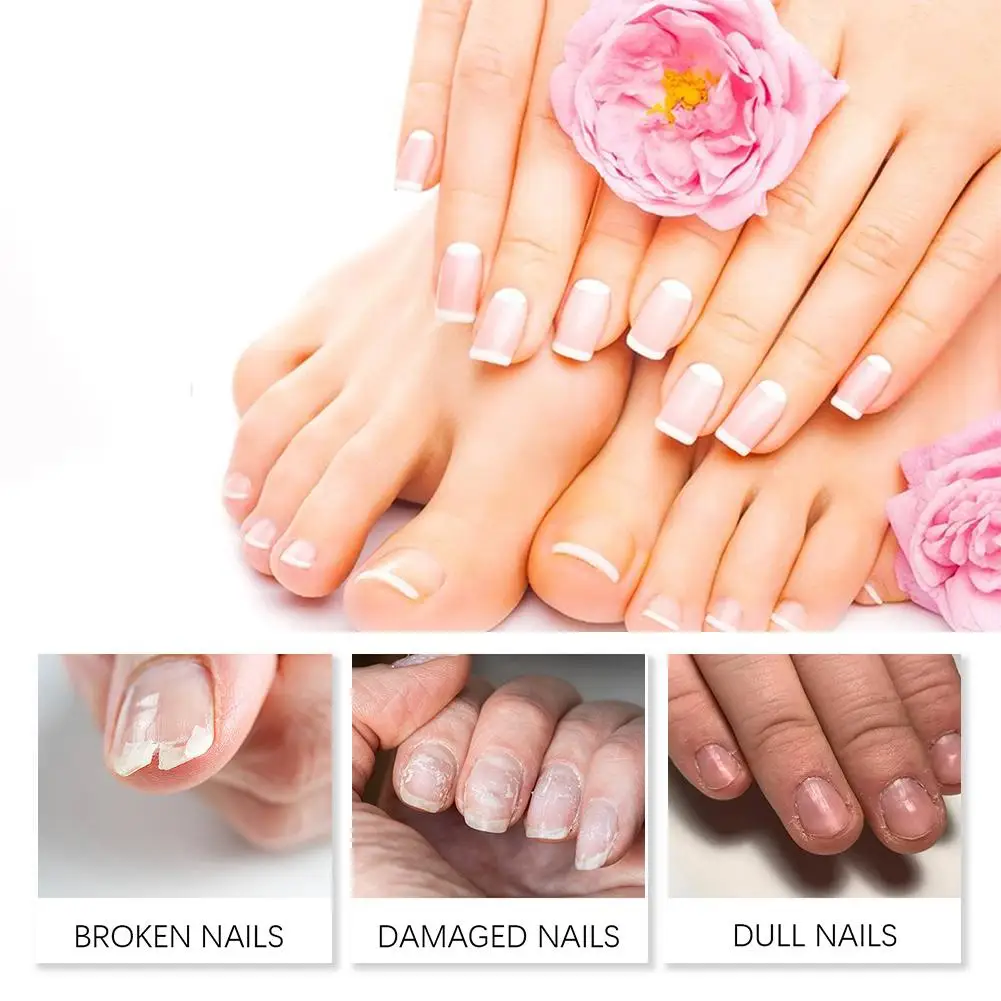 2025年新発売 ネイルリペアパッチケア  黄ばみ・厚み改善・爪の割れを修復  爪の病気の方にも最適 ﻿   Q7R3 ？