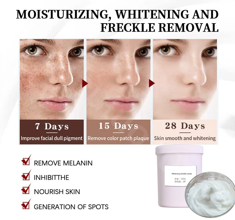 Original Whitening Freckles Face Cream Corrector Fade Dark Spots Melasma Inhibit Melanin Lighten Skin Hydrating Beauty Skincare